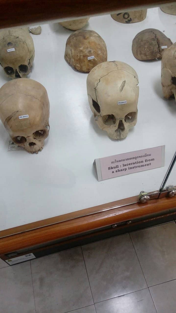 Forensic Pathology Exhibits