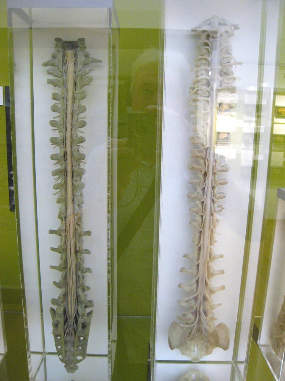 Pathological Displays