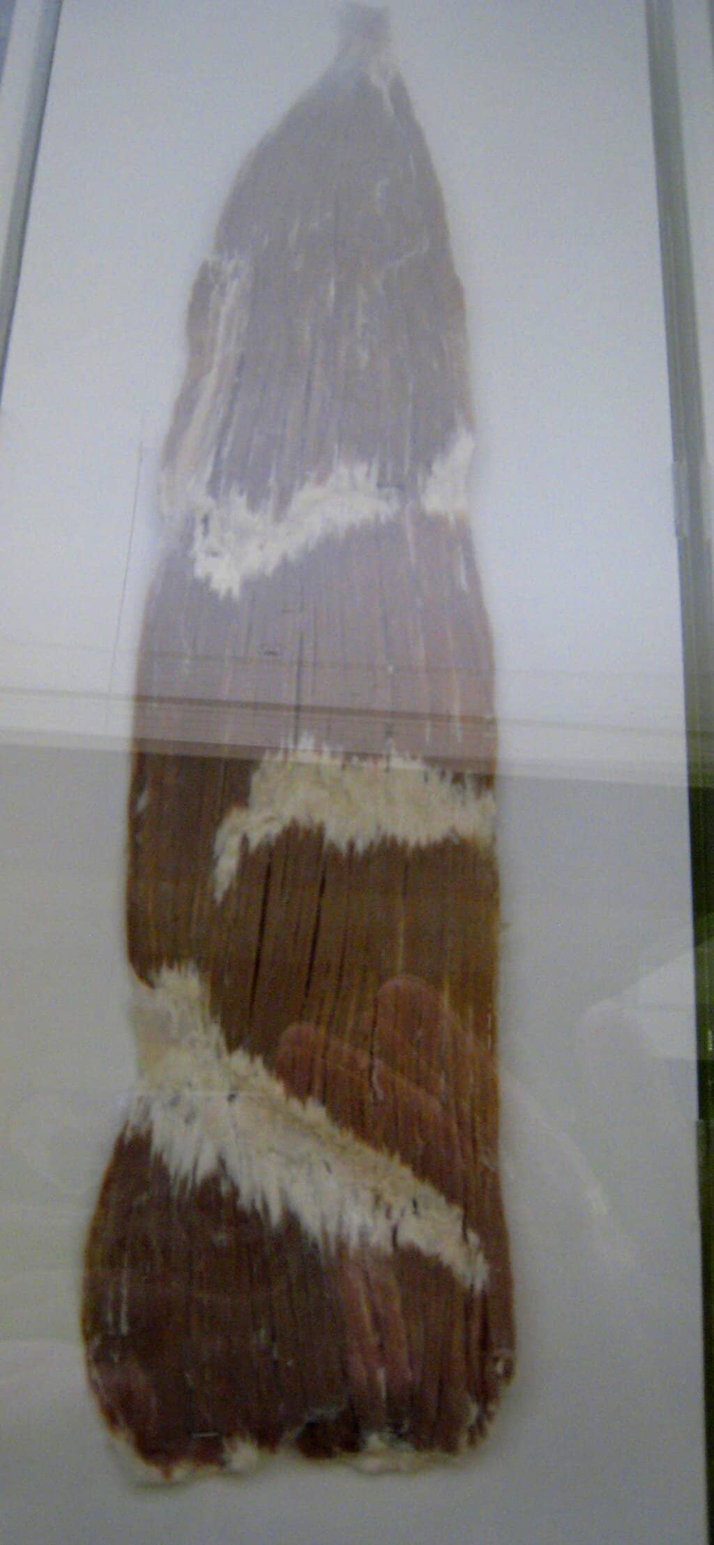 Organ and Tissue Specimens