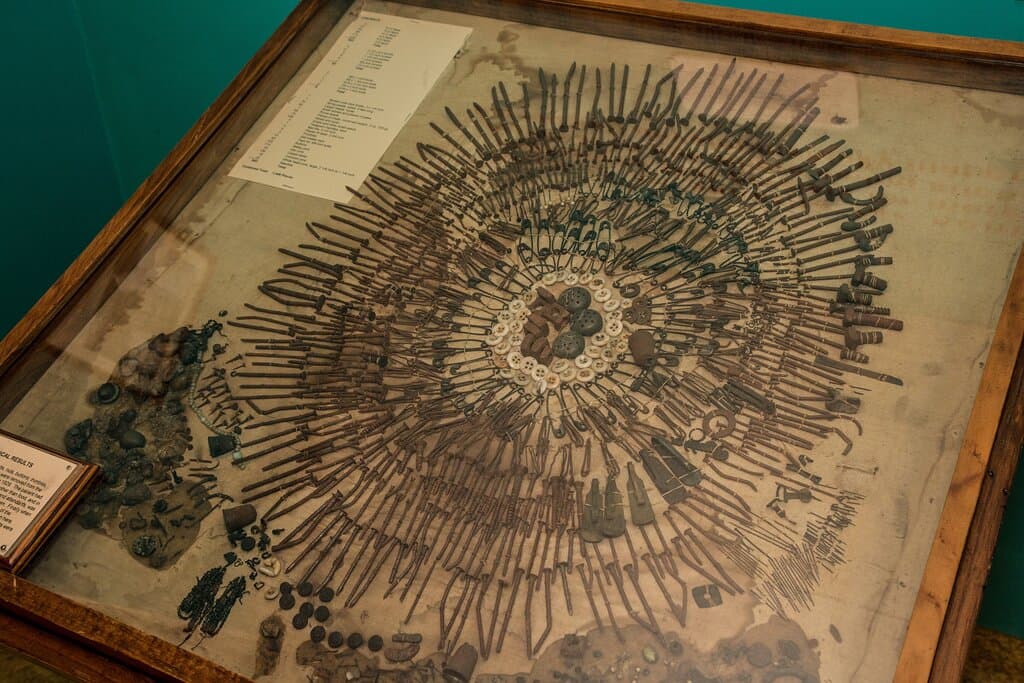 Stomach contents of a female patient suffering from pica.