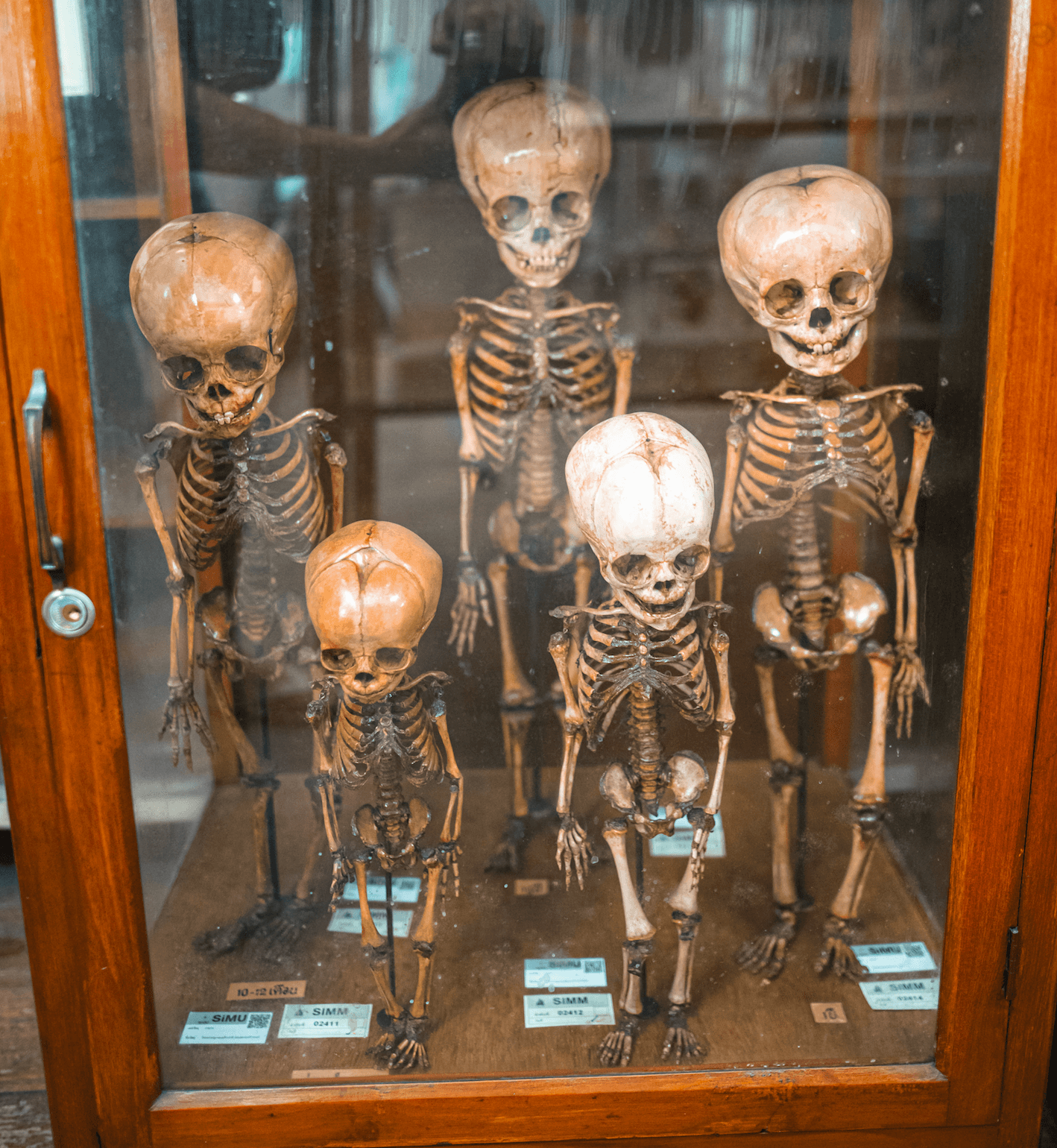 Forensic Pathology Exhibits