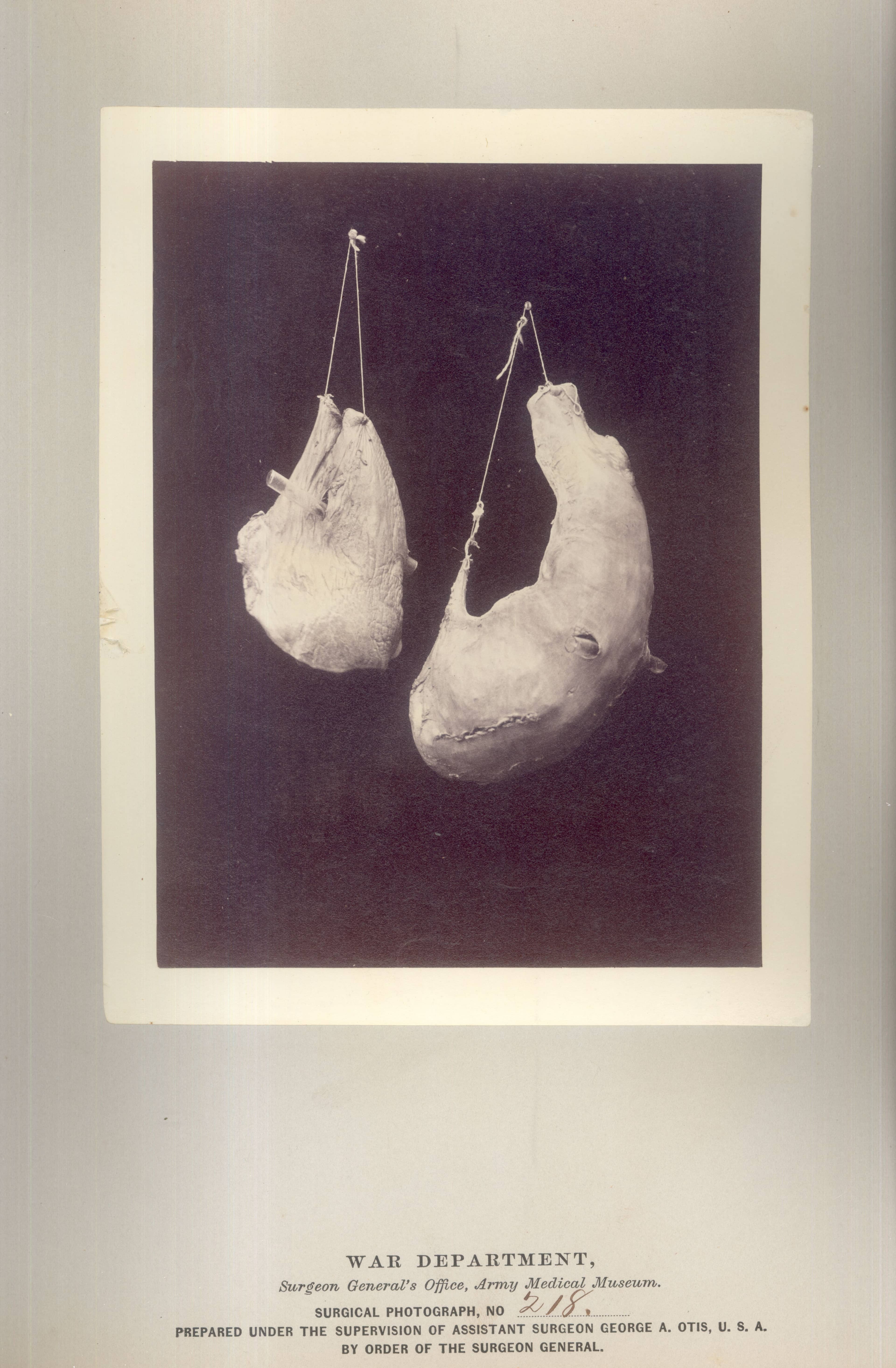 Civil War Medical Specimens