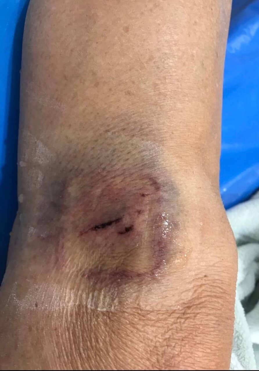 Crystal-Clear Waters