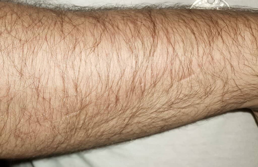 Fantastic Hamburgers